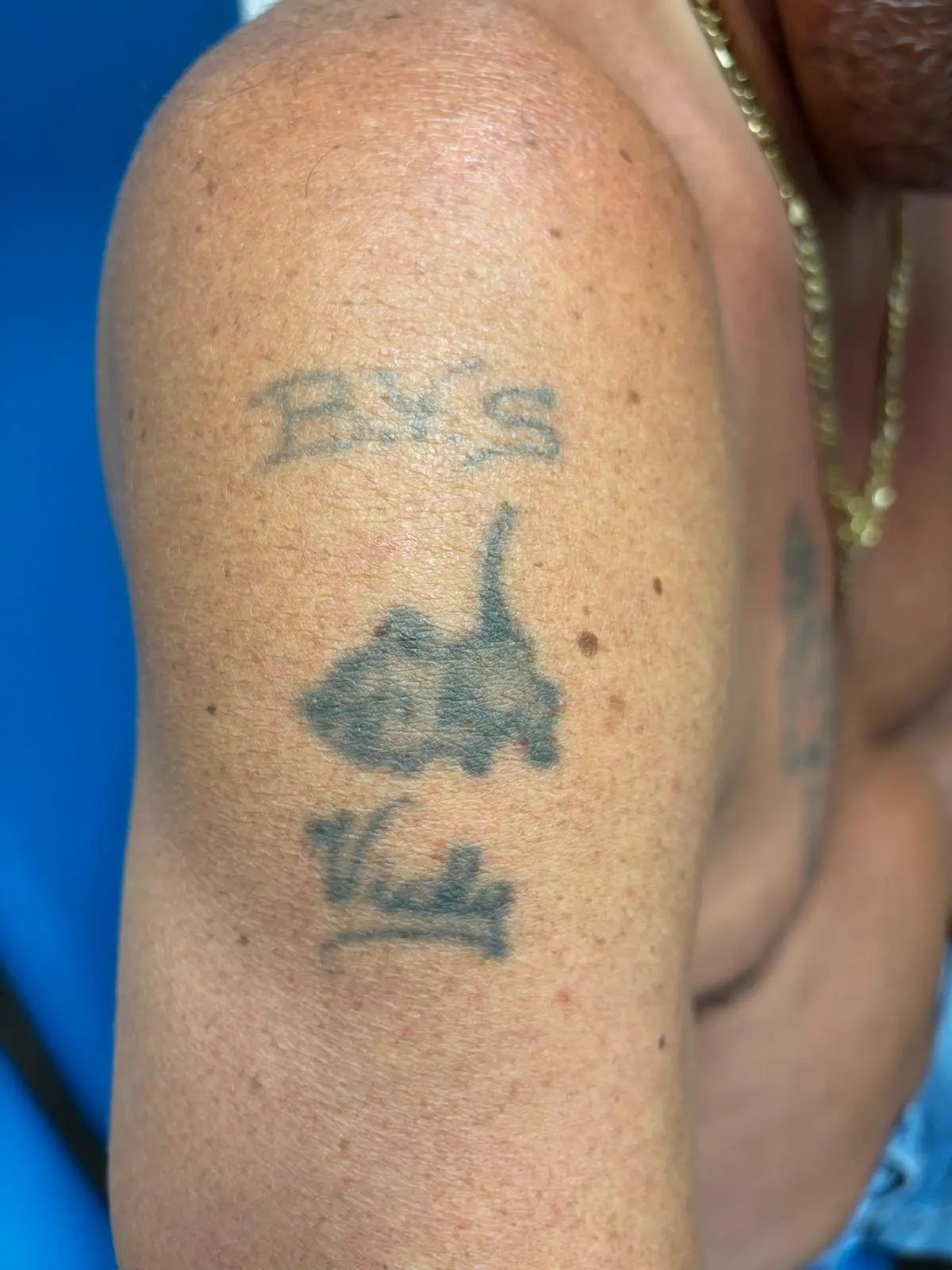 Hond tattoo, schouder — voor PICO-laser sessie 1