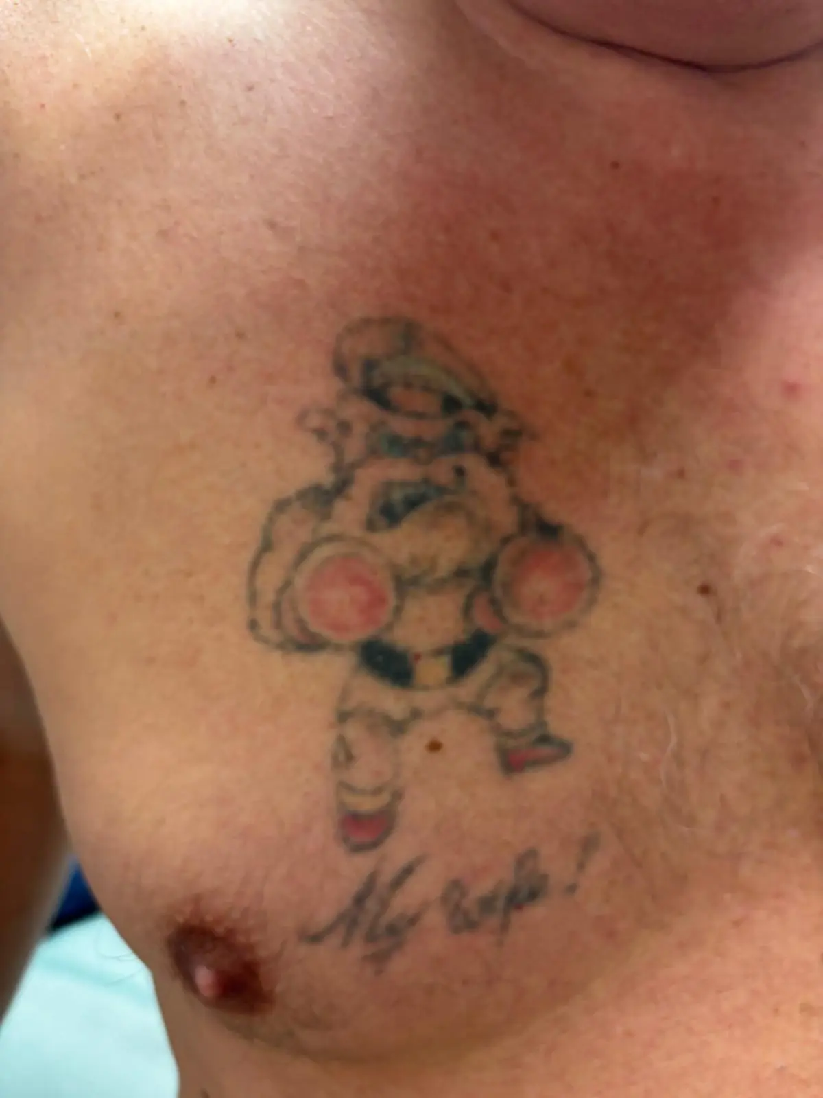 Boxer hond tattoo, borst — na 1 PICO-laser sessie